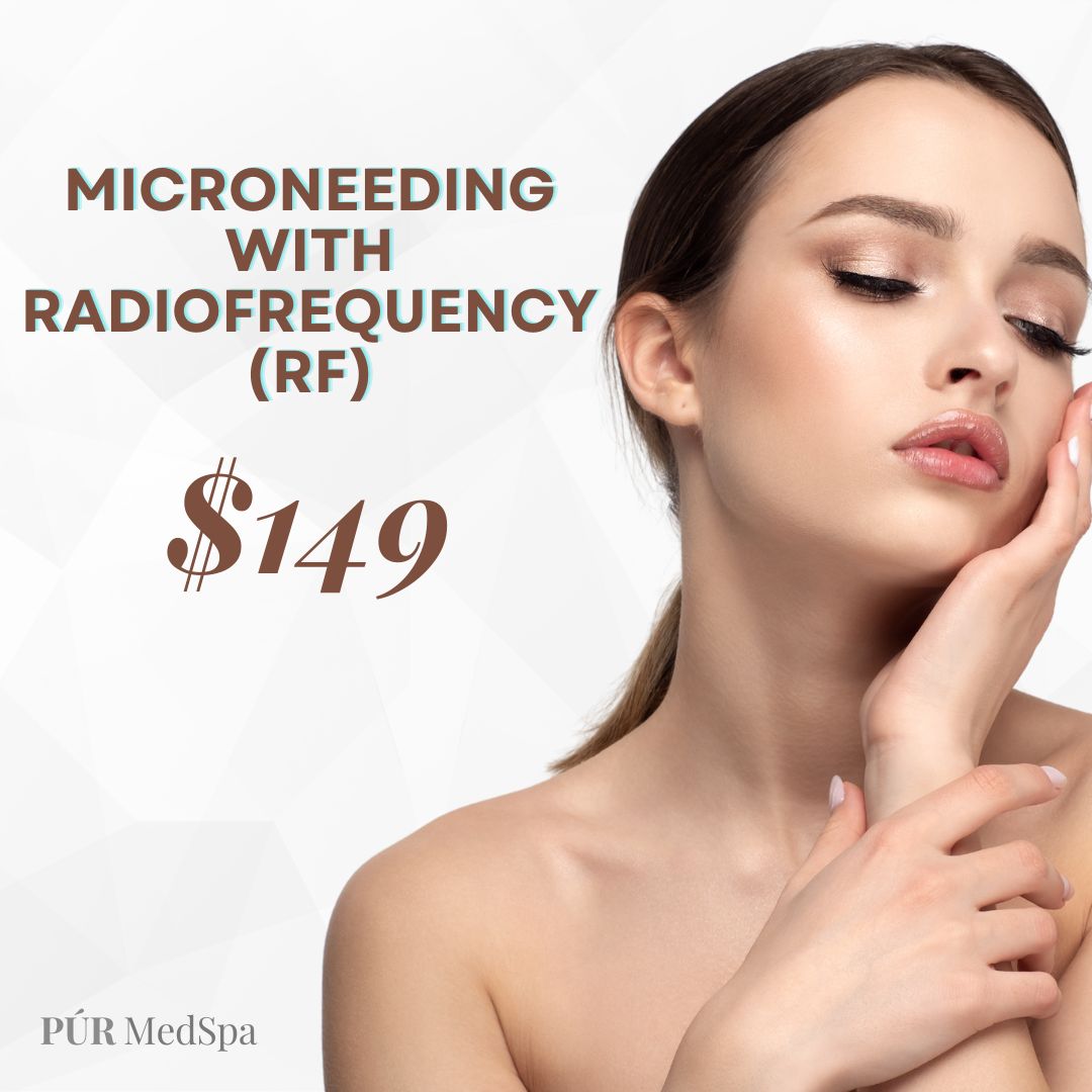 Microneedling with Radiofrequency (RF)